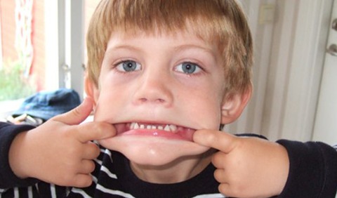 Pojke som visar sina tänder